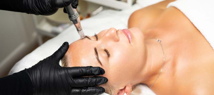 What Are the Benefits of RF Microneedling? | True Medical Aesthetics What Are the Benefits of RF Microneedling? | True Medical Aesthetics