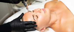 What Are the Benefits of RF Microneedling? | True Medical Aesthetics What Are the Benefits of RF Microneedling? | True Medical Aesthetics