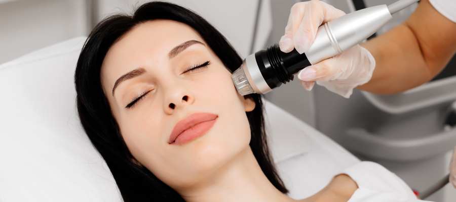 Stimulate Collagen Regeneration with RF Microneedling | True Medical Aesthetics Near Me in Avon, CT