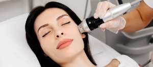 Stimulate Collagen Regeneration with RF Microneedling | True Medical Aesthetics Near Me in Avon, CT