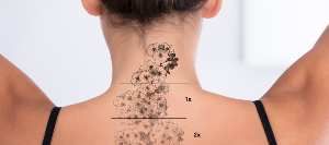 Tattoo Removal Cost Near Me in Avon, CT Tattoo Removal Cost Near Me in Avon, CT
