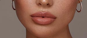 Is a Lip Flip Right for You | True Medical Aesthetics in Avon, CT