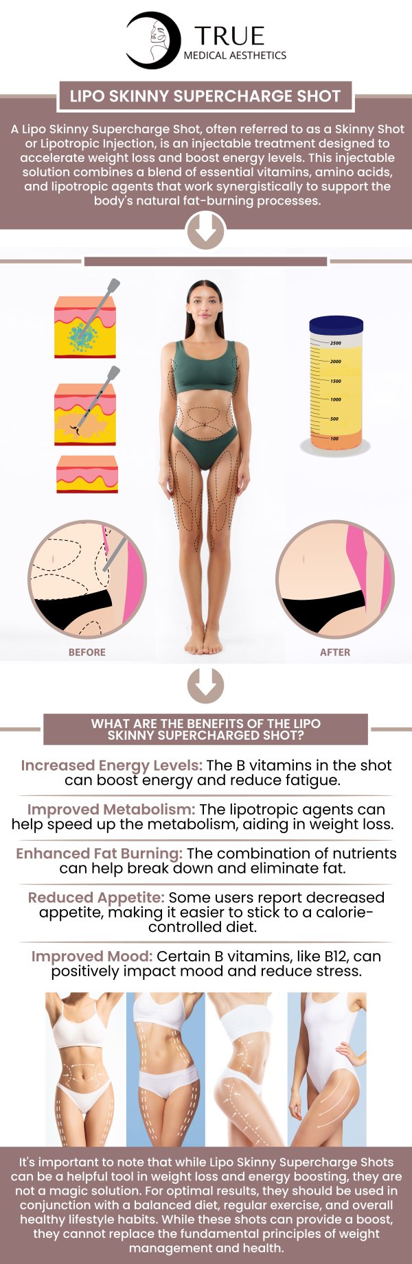 Lipo shots are often used to support fat reduction by providing nutrients that help the body break down stored fat more effectively. These shots are typically combined with healthy lifestyle choices, as they can boost energy levels and enhance metabolism. It's important to discuss your health goals with Tristen Durkin, RN, to determine if lipo shots are the right option for you. For more information, please contact us or schedule an appointment online. We are conveniently located at 50 Avon Meadow Ln, Avon, CT 06001.