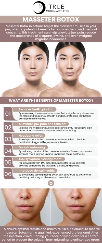 At True Medical Aesthetics, Tristen Durkin, RN, offers specialized Masseter Botox treatments to provide relief for those suffering from the persistent ache of TMJ disorders and bruxism. Serving the Avon community, we focus on using precision-guided injections to relax the jaw muscles, reducing pain and preventing the long-term dental damage associated with chronic teeth grinding. For more information, please contact us or schedule an appointment online. We are conveniently located at 50 Avon Meadow Ln, Avon, CT 06001.