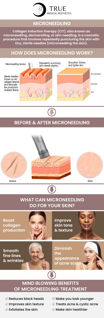 RF microneedling offers a comprehensive solution for a wide range of issues, including fine lines, stubborn wrinkles, acne scars, enlarged pores, uneven skin tone, and skin laxity. The result is a smoother, firmer, and more youthful-looking complexion that continues to improve in the weeks and months following your treatment as the new collagen matures. Visit Tristen Durkin, RN to rejuvenate your skin. For more information, please contact us or schedule an appointment online. We are conveniently located at 50 Avon Meadow Ln, Avon, CT 06001. RF microneedling offers a comprehensive solution for a wide range of issues, including fine lines, stubborn wrinkles, acne scars, enlarged pores, uneven skin tone, and skin laxity. The result is a smoother, firmer, and more youthful-looking complexion that continues to improve in the weeks and months following your treatment as the new collagen matures. Visit Tristen Durkin, RN to rejuvenate your skin. For more information, please contact us or schedule an appointment online. We are conveniently located at 50 Avon Meadow Ln, Avon, CT 06001.
