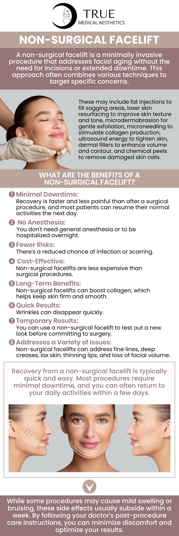 At True Medical Aesthetics, Tristen Durkin, RN, offers non-surgical facelift treatments that can rejuvenate and revitalize your skin. Using advanced, minimally invasive techniques, Tristen helps smooth wrinkles, lift sagging areas, and restore youthful contours, all without the need for surgery. For more information, please contact us or schedule an appointment online. We are conveniently located at 50 Avon Meadow Ln, Avon, CT 06001. At True Medical Aesthetics, Tristen Durkin, RN, offers non-surgical facelift treatments that can rejuvenate and revitalize your skin. Using advanced, minimally invasive techniques, Tristen helps smooth wrinkles, lift sagging areas, and restore youthful contours, all without the need for surgery. For more information, please contact us or schedule an appointment online. We are conveniently located at 50 Avon Meadow Ln, Avon, CT 06001.